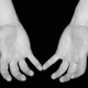Image for article titled Is Self-Injury A Mental Disorder, Or Just Part Of A Larger Problem?
